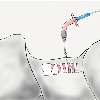 pulmonologist in Vijayawada